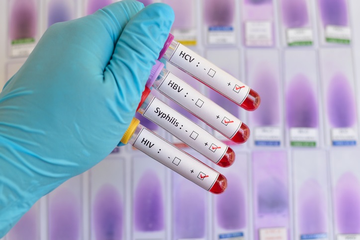 Look Ma, and You’ll Be Able To Truly Construct A Bussiness std test kit