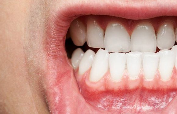 What are the Symptoms of Dental Issues?