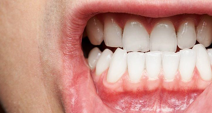 What are the Symptoms of Dental Issues?