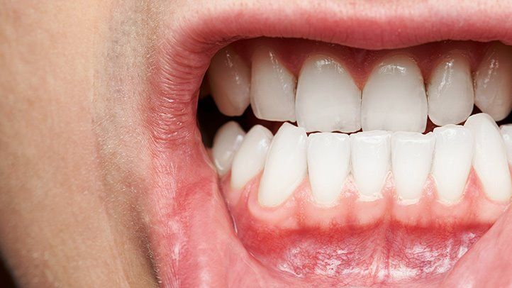 What are the Symptoms of Dental Issues?