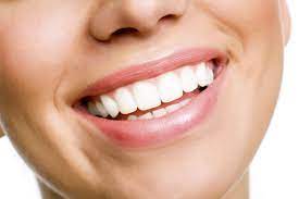 The Enticing Benefits of Professional Teeth Whitening