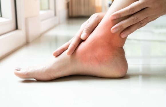 Is Athlete’s Foot Contagious, and Can It Be Prevented?