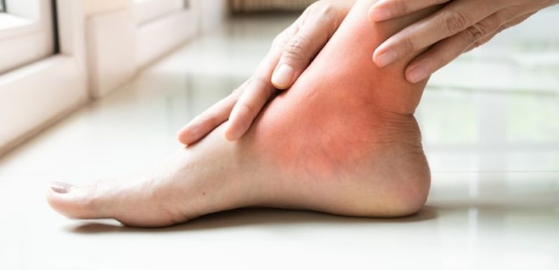 Is Athlete’s Foot Contagious, and Can It Be Prevented?