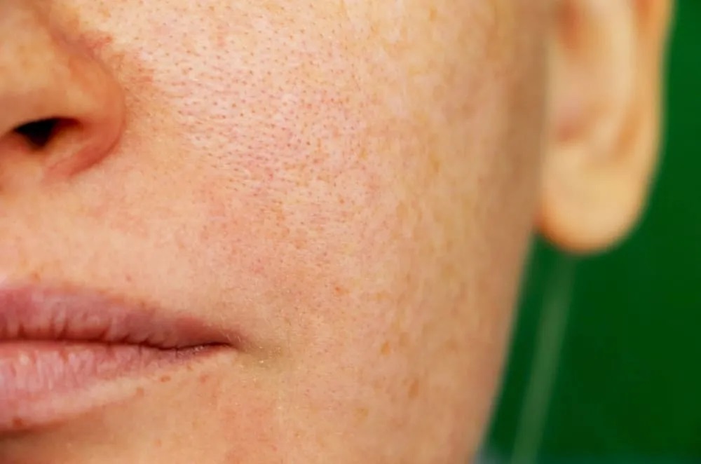 Minimizing the Enlarged Pore Conditions – Causes and Some Solutions Minimizing the Enlarged Pore Conditions