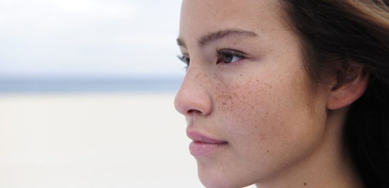 Pigmentation Removal Singapore: What are the Potential Side Effects?