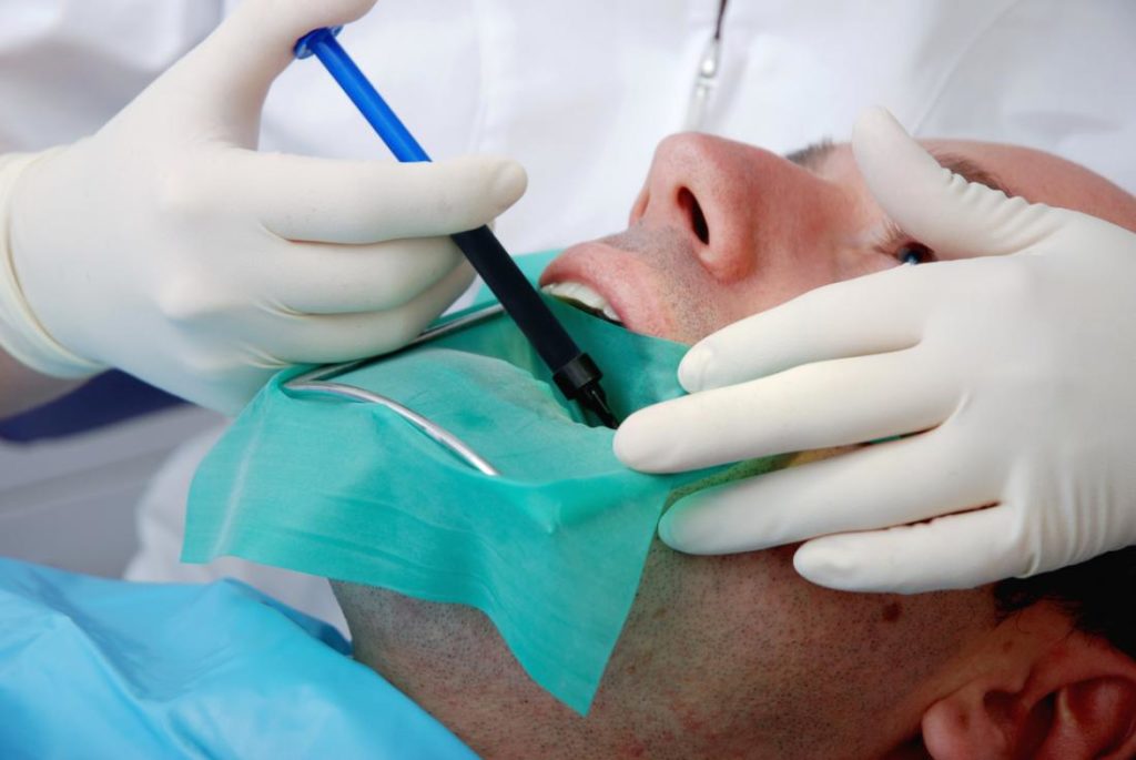 How To Manage Pain After Having Your Root Canal Therapy in Wilmington, DE?