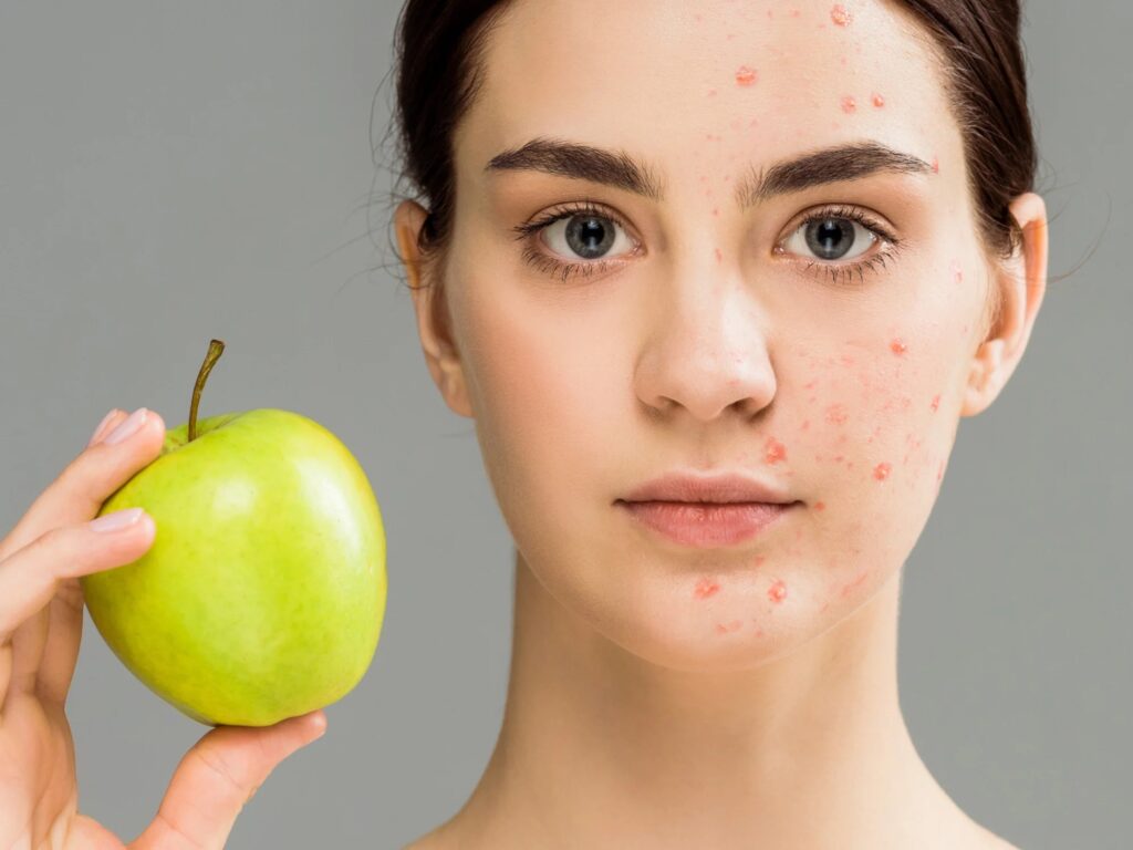 Why Your Skin Expert Can Save Your Skin with a Diet