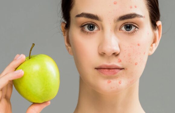 Why Your Skin Expert Can Save Your Skin with a Diet