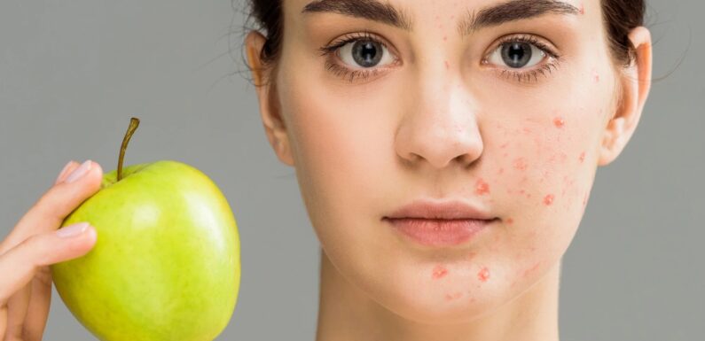 Why Your Skin Expert Can Save Your Skin with a Diet