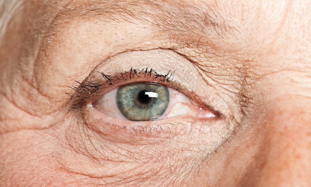 Link Between Aging and Macular Degeneration Macular Degeneration