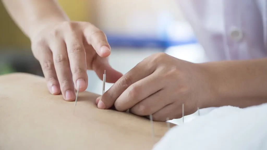 Tailored Acupuncture Solutions by Anne-Marie Cote for Chronic Conditions