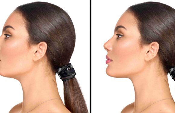 Defining Elegance: A Comprehensive Guide to Chin Surgery Prices with a Focus on Dubai