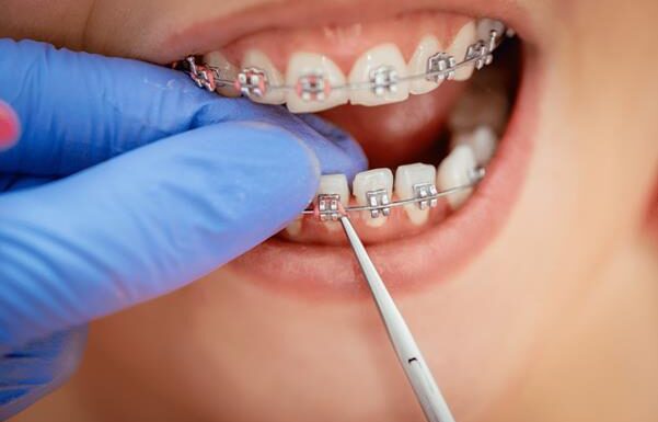 The Link Between Oral Health And Overall Wellness In Families