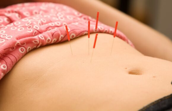 How Fertility Acupuncture Reduces Stress and Improves Egg Quality
