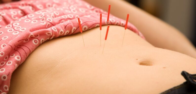 How Fertility Acupuncture Reduces Stress and Improves Egg Quality