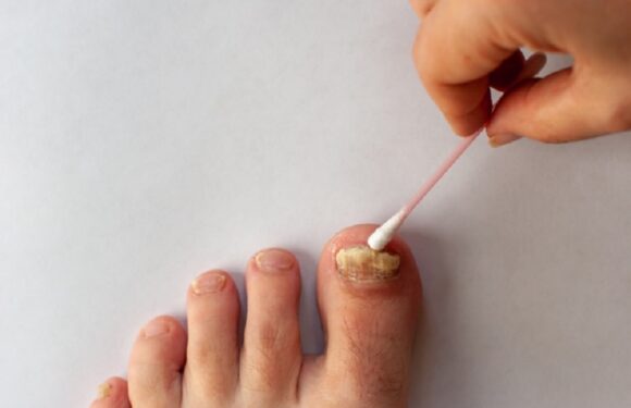 Okita Nail Fungus Light Reviews: Real User Results and Expert Analysis