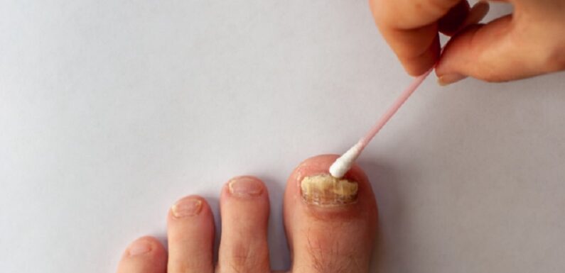 Okita Nail Fungus Light Reviews: Real User Results and Expert Analysis
