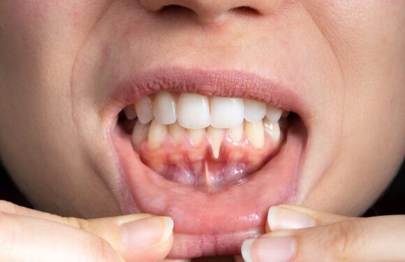 4 Common Preventive Services That Protect Against Gum Disease