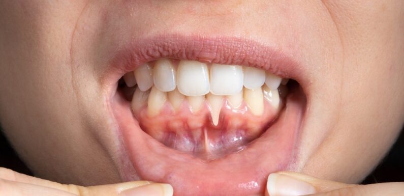 4 Common Preventive Services That Protect Against Gum Disease