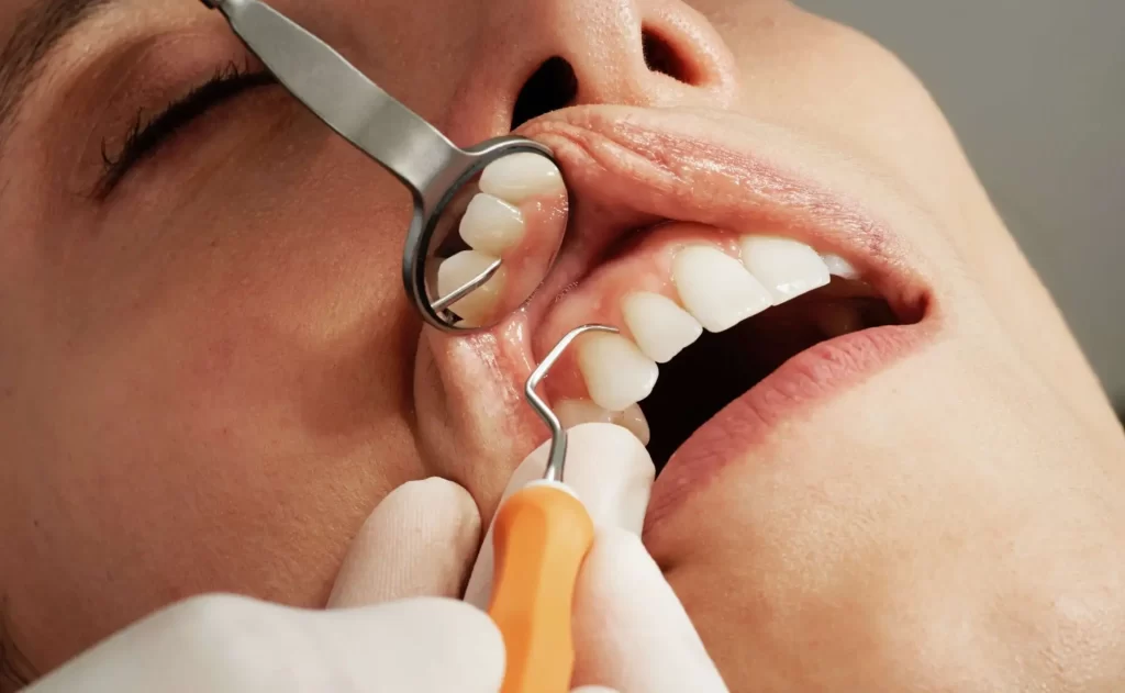 Why Building A Dental Home Is Essential For Long Term Wellness