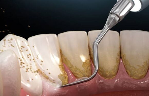 Expert Periodontal Care from a Trusted Sydney Specialist