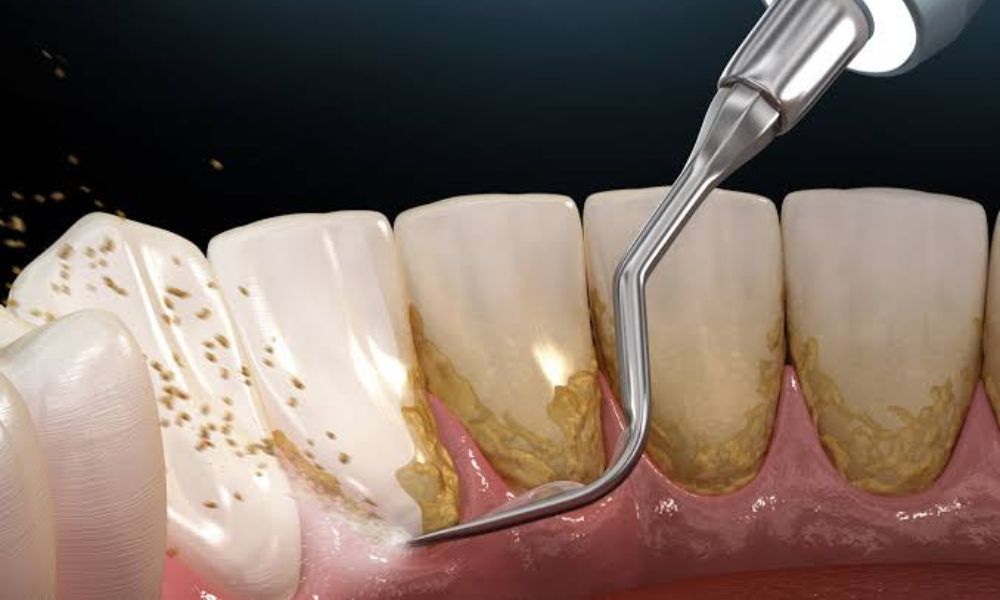Expert Periodontal Care from a Trusted Sydney Specialist periodontist