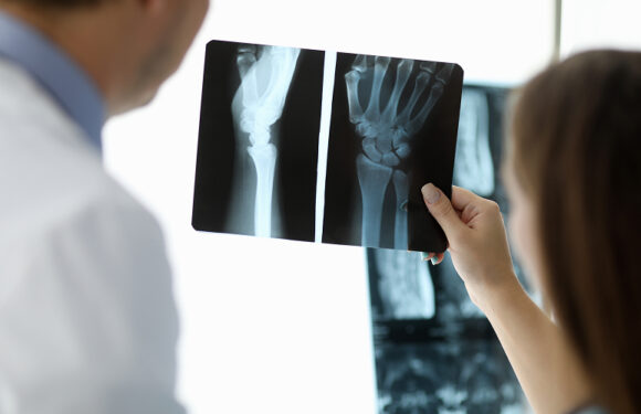 Choosing the Right Hand Surgeon in Singapore