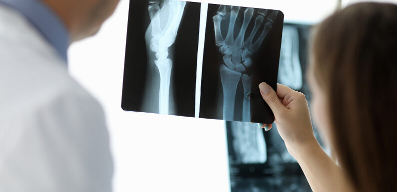 Choosing the Right Hand Surgeon in Singapore