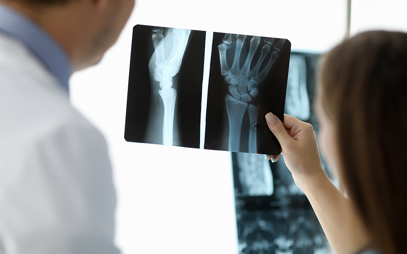 Choosing the Right Hand Surgeon in Singapore