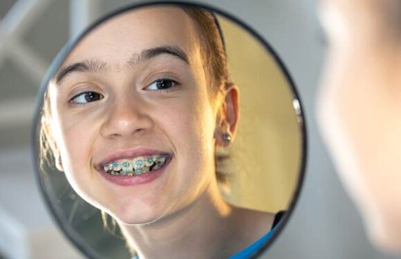 What You Must Know About Cheap Braces in Singapore