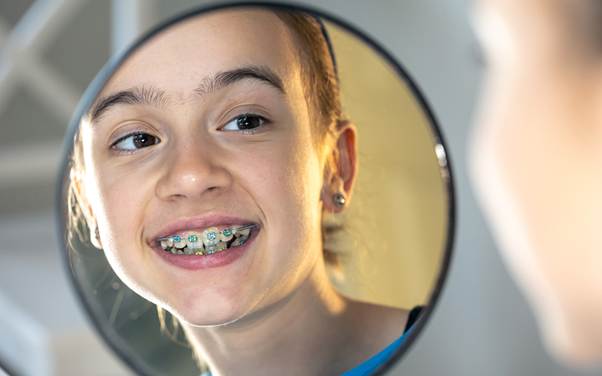 What You Must Know About Cheap Braces in Singapore