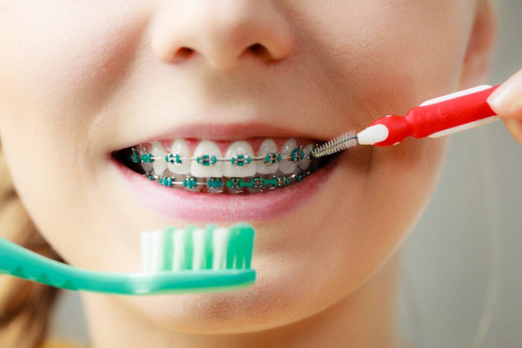 6 Tips For Caring For Your Teeth During Orthodontic Treatment