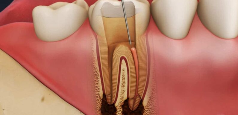 How an Endodontist in Singapore Uses 3D Imaging for Comprehensive Treatment
