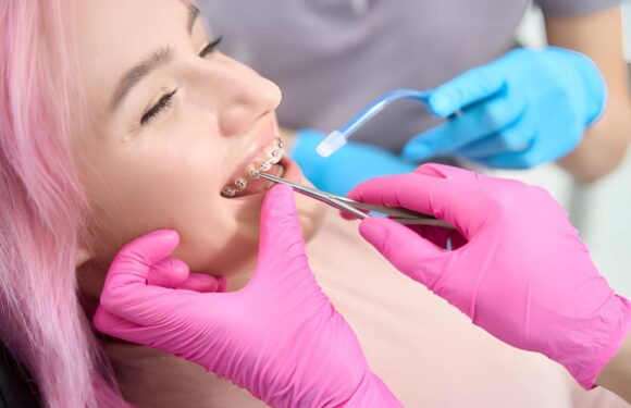 Understanding Your Fixed Metal Bracket Braces Options