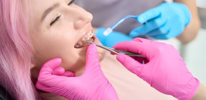 Understanding Your Fixed Metal Bracket Braces Options