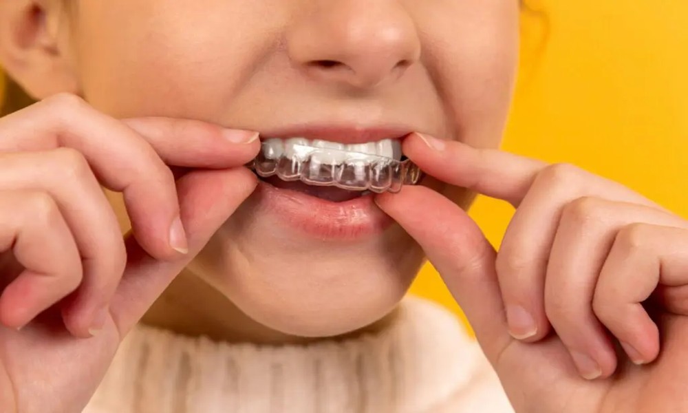 6 Tips For Maintaining Oral Health During Braces Or Aligners