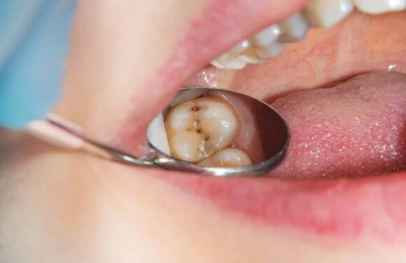 Why Fluoride Treatments Protect Against Generational Cavity Risks