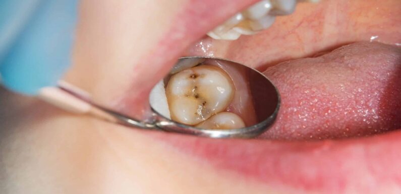 Why Fluoride Treatments Protect Against Generational Cavity Risks