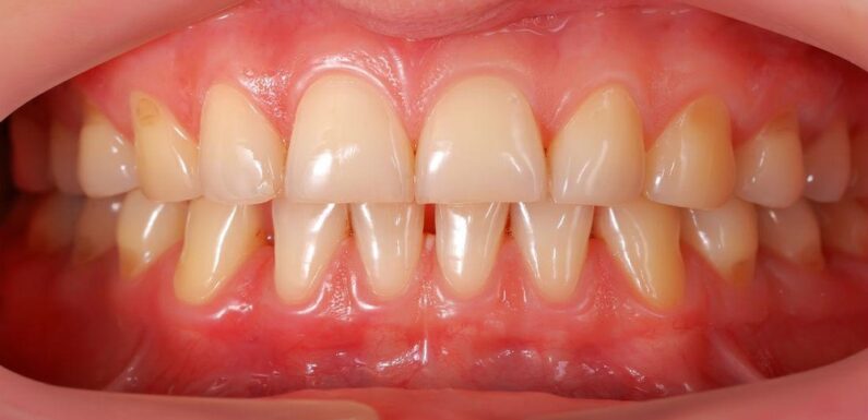 Why Gum Health Is The Make Or Break Factor For Cosmetic Dentistry