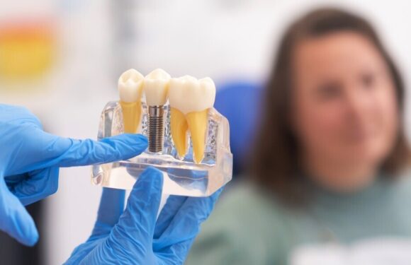 Why Dental Professionals Matter for Everyday Oral Care