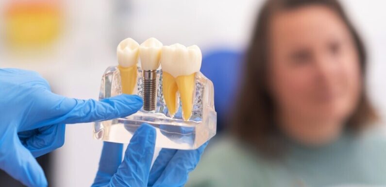 Why Dental Professionals Matter for Everyday Oral Care