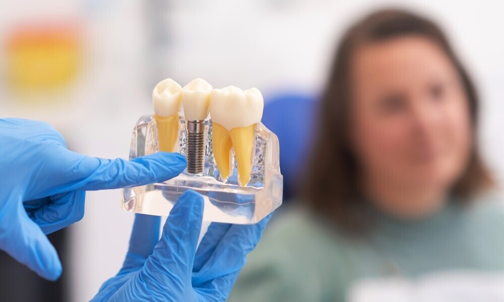 Why Dental Professionals Matter for Everyday Oral Care