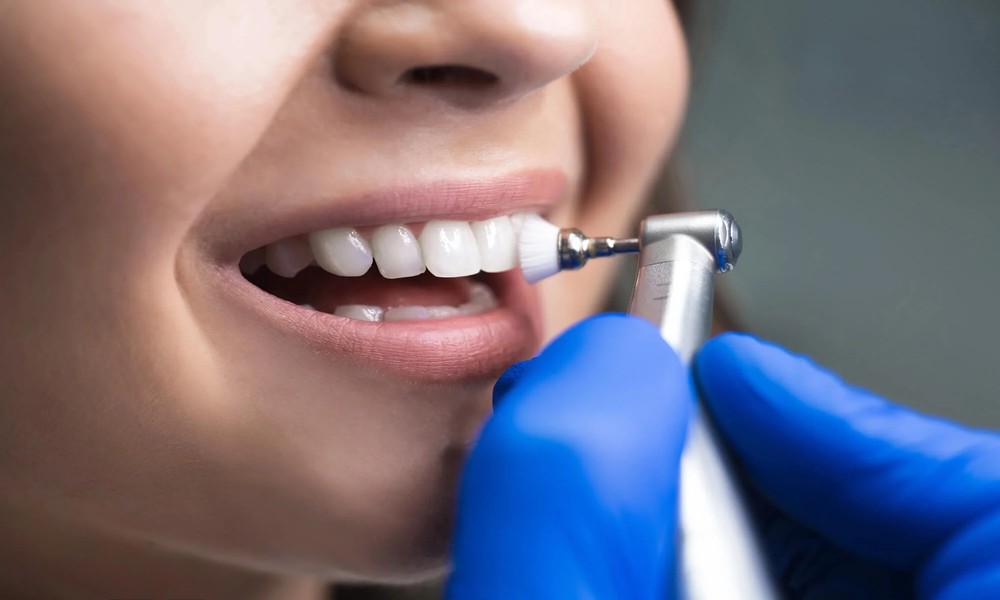 Why Professional Dental Cleanings Are Essential In General Dentistry