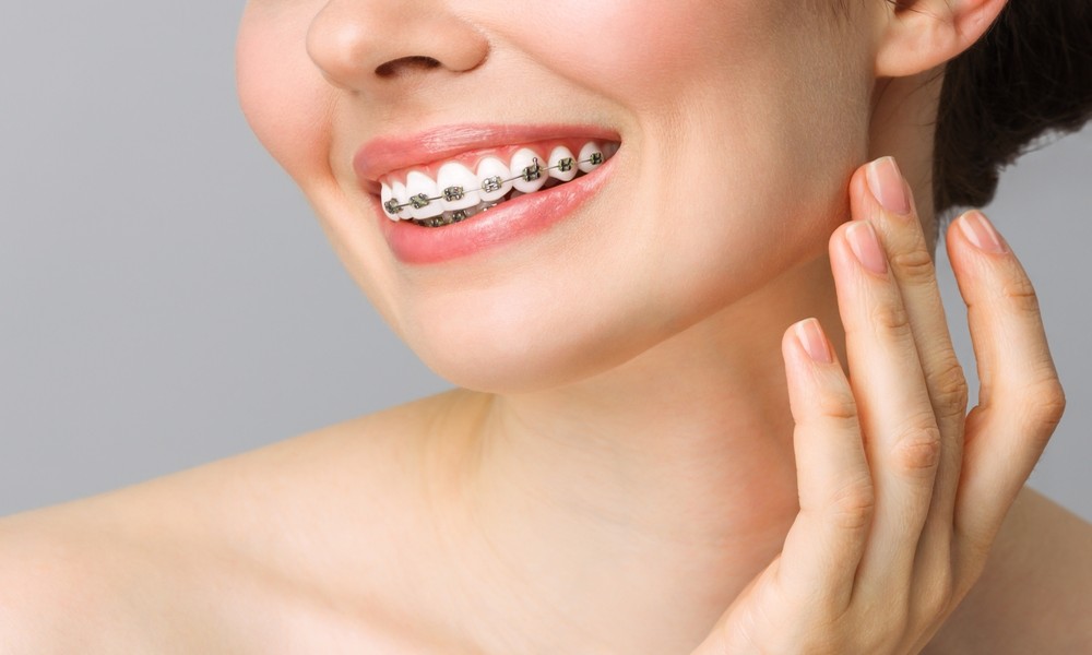 How Orthodontic Care Enhances Confidence And Everyday Smiles