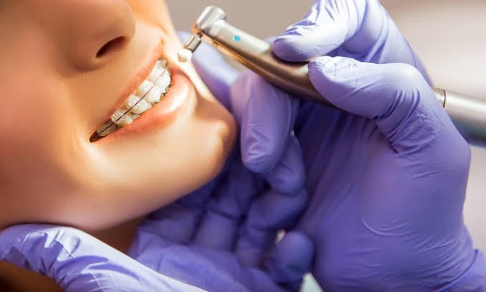 3 Advantages Of Choosing A Specialist For Orthodontic Care