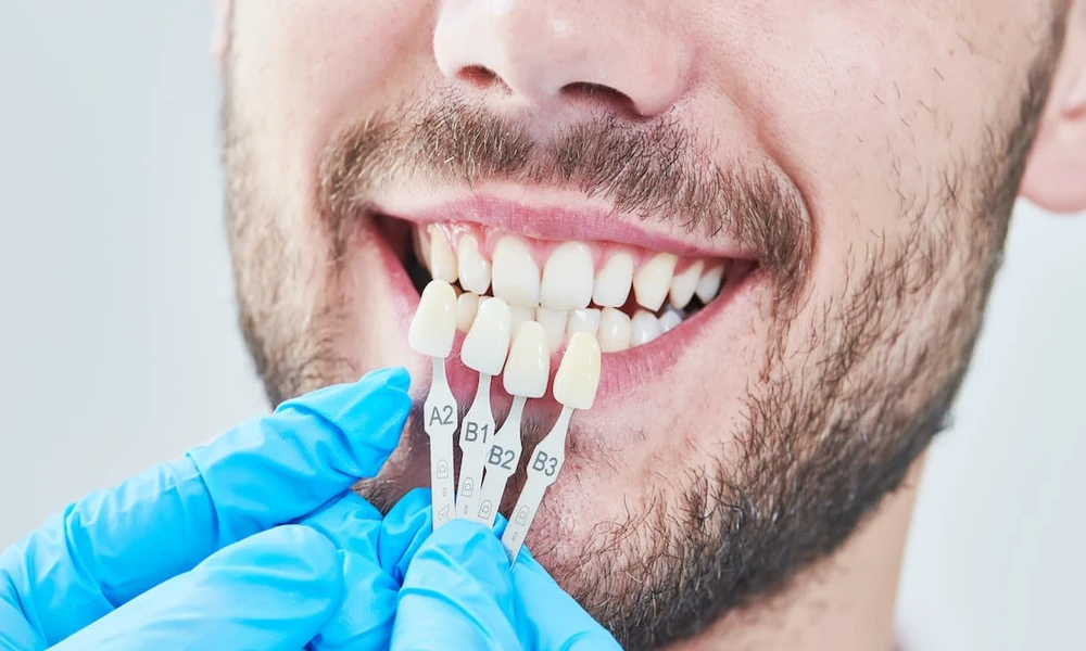 6 Smile Care Strategies From Dentists Who Blend Health And Beauty