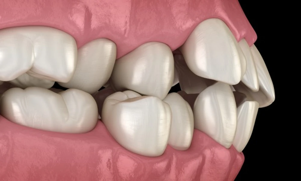 How Orthodontic Services Support Better Speech And Chewing