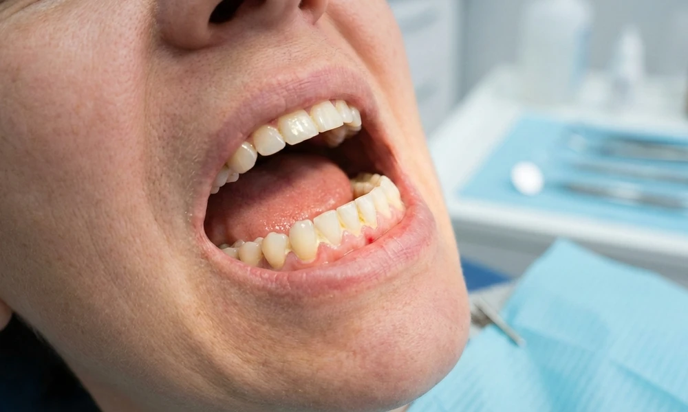 5 Signs Your Oral Care Routine Is Working