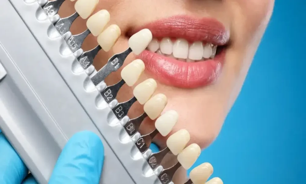 6 Cosmetic Dentistry Services That Work For Parents And Teens Alike